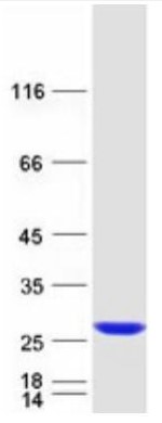 SDS PAGE (RAB38-2076HFL).jpg